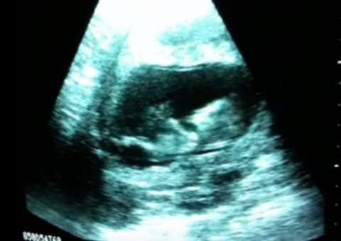 Não é chute! Saiba o que o bebê realmente faz dentro da barriga