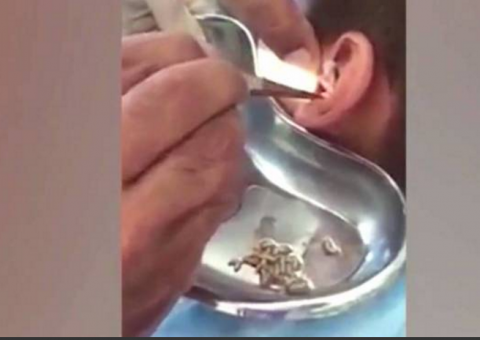 Criança reclama com fortes dores no ouvido e médicos ficam chocados