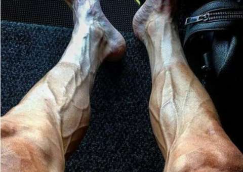 Ciclista posta foto impressionante de suas pernas e imagem viraliza