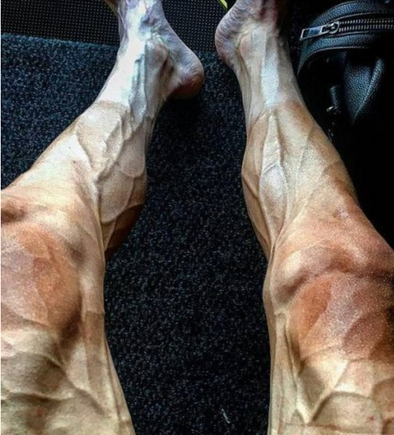 Ciclista posta foto impressionante de suas pernas e imagem viraliza