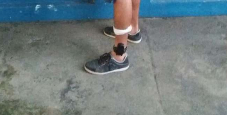 Projeto que obriga preso a pagar pela própria tornozeleira deve ser votado em agosto