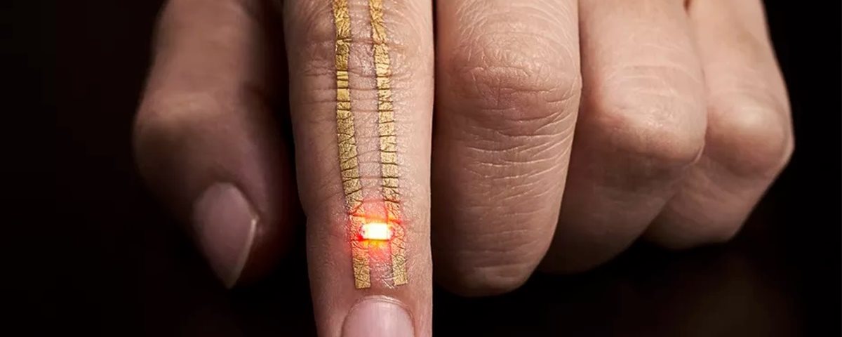 Japoneses criam tatuagem de ouro capaz de armazenar e transmitir dados