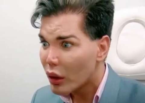 Mesmo correndo risco de nariz cair, Ken Humano brasileiro gasta R$ 130 mil em novas cirurgias