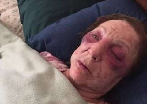 Idosa é agredida brutalmente um dia antes de ir ao funeral do marido 