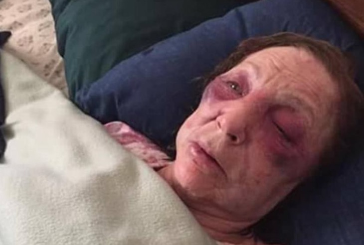 Idosa é agredida brutalmente um dia antes de ir ao funeral do marido 