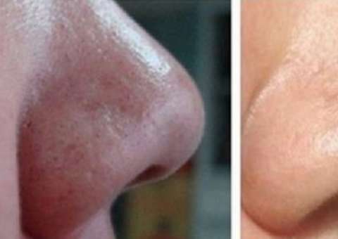 7 Usos do bicarbonato de sódio que vão deixar você mais bonito