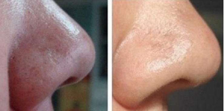 7 Usos do bicarbonato de sódio que vão deixar você mais bonito