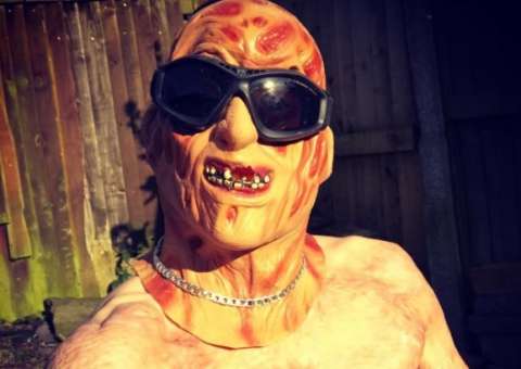 Após ter 80% do corpo queimado, homem tem reação inesperada 