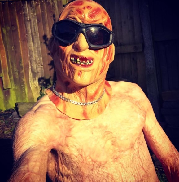 Após ter 80% do corpo queimado, homem tem reação inesperada 