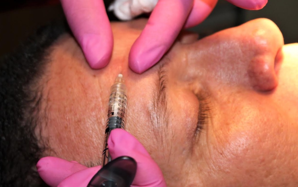 Novidades da estética orofacial chegam à Parintins