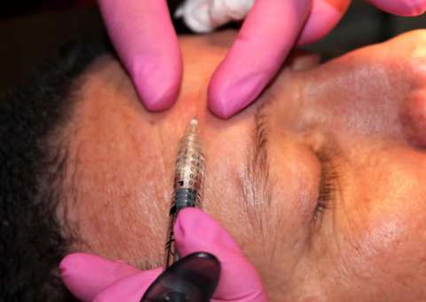 Novidades da estética orofacial chegam à Parintins