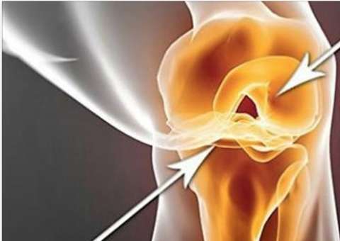 Essa bebida ajuda reconstruir cartilagem, ligamentos e acaba com dor nos joelhos