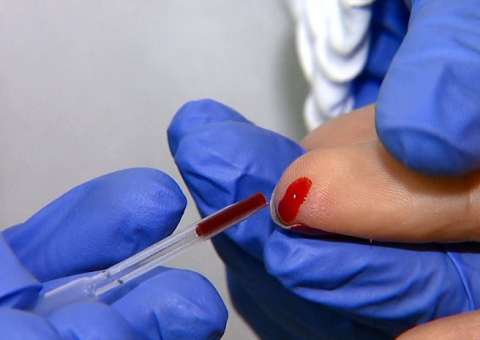 Cardiologistas estabelecem taxas mais rígidas de controle do 'colesterol ruim'