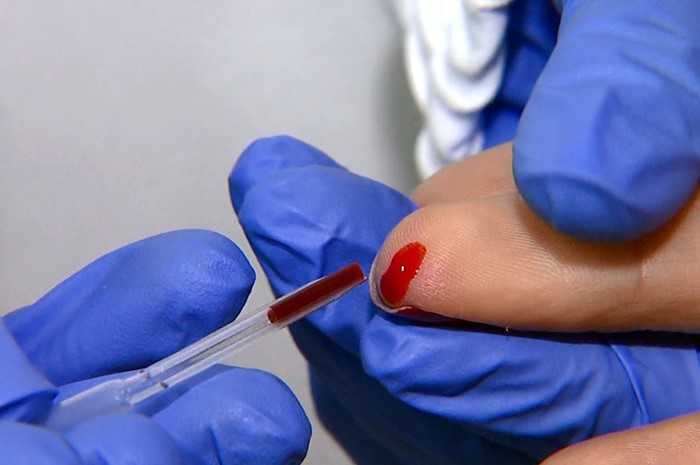 Cardiologistas estabelecem taxas mais rígidas de controle do 'colesterol ruim'