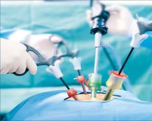 Governo dá versão errada sobre cirurgias superfaturadas