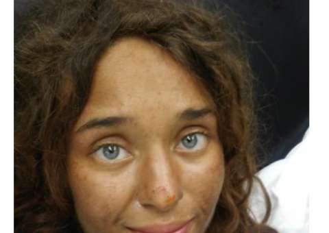 Jovem sobrevive a semanas perdida em floresta e emagrece mais de 20 kg