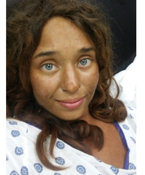 Jovem sobrevive a semanas perdida em floresta e emagrece mais de 20 kg
