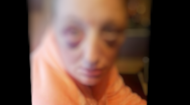 Após recusar sexo, mulher é torturada com chave de fenda e abusada por homem