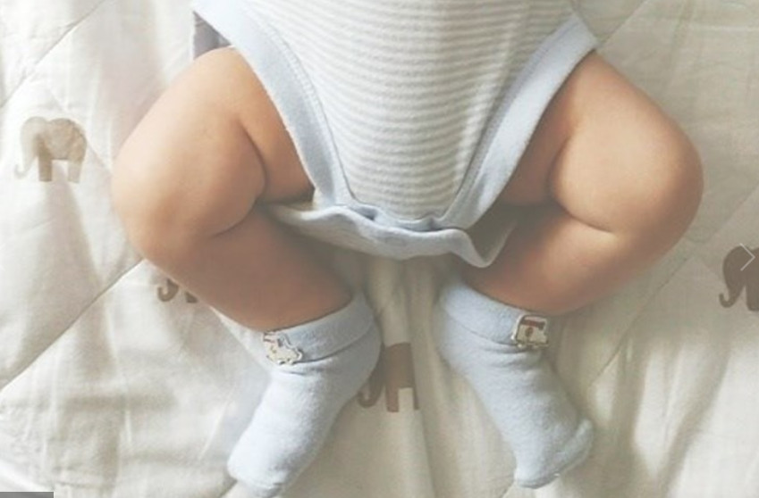 Mulher troca fralda do filho e pernas ficam fraturadas 