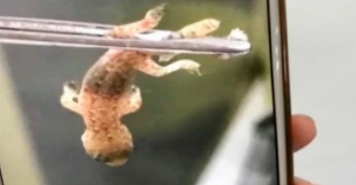 Homem vai parar no hospital com 'coisa' se mexendo no ouvido e médicos ficam surpresos ao ver o que era