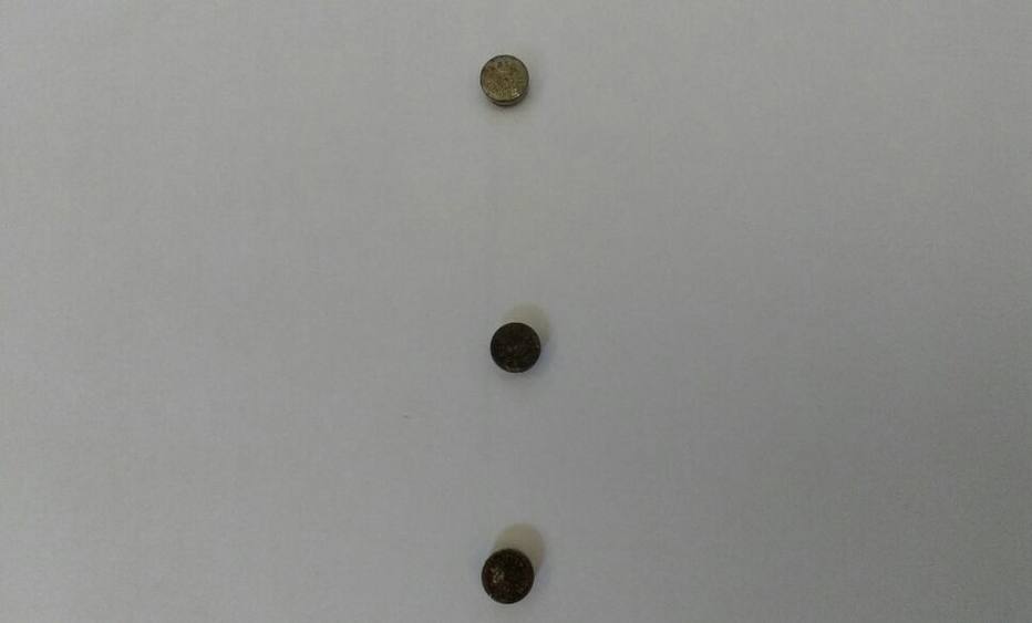 Menina de 2 anos entra em penitenciária com três baterias no intestino