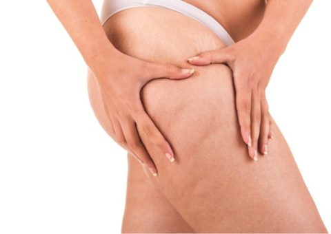 Saiba quais alimentos ajudam a amenizar a celulite