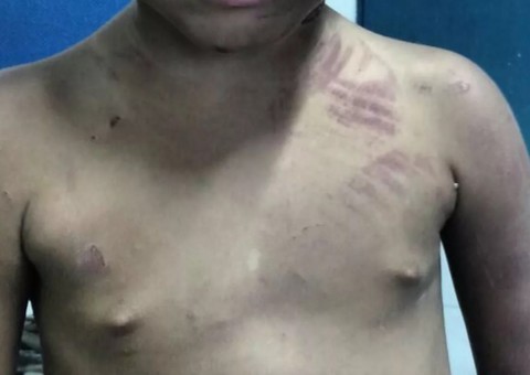 Pai tenta matar o próprio filho enforcado e ainda coloca pimenta em partes íntimas 