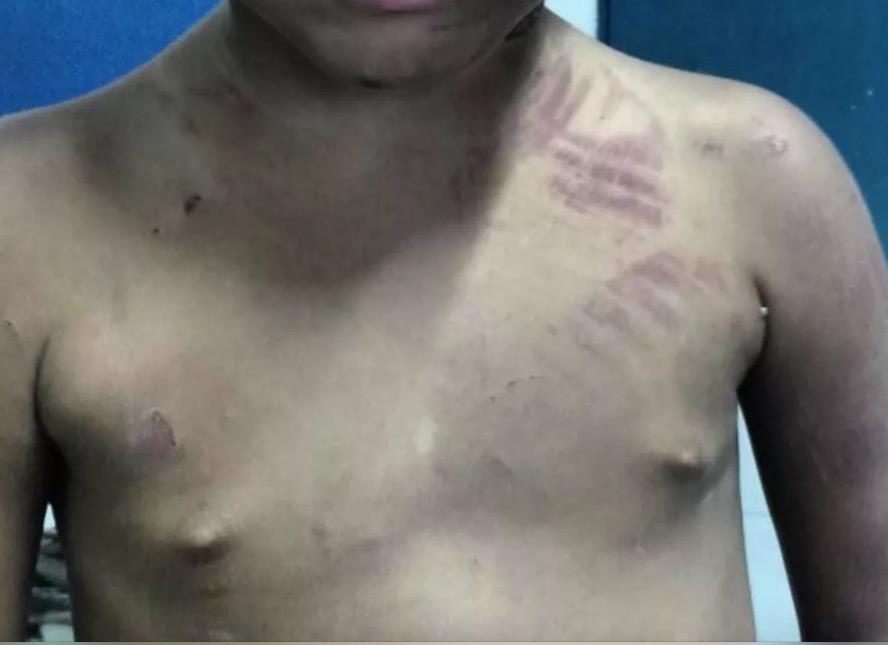 Pai tenta matar o próprio filho enforcado e ainda coloca pimenta em partes íntimas 