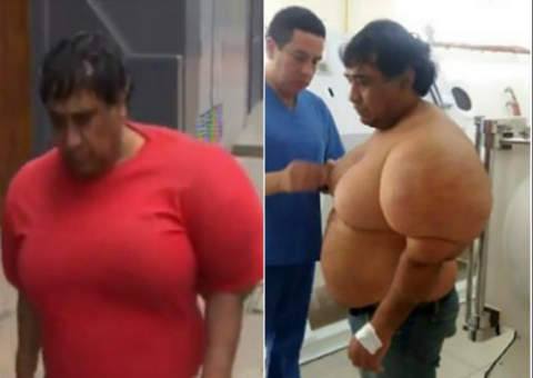 Mergulhador fica com corpo deformado após acidente bizarro