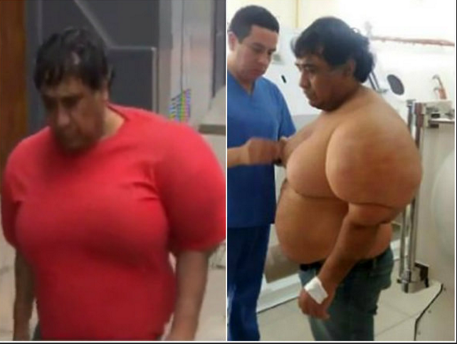 Mergulhador fica com corpo deformado após acidente bizarro