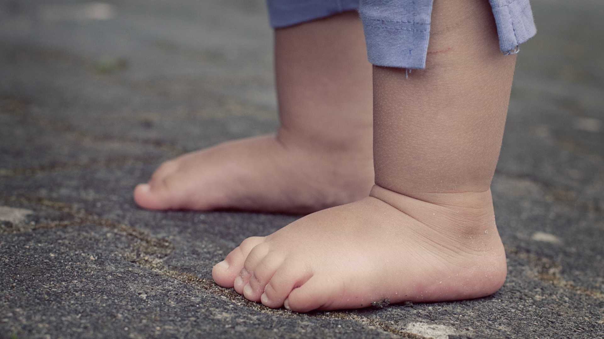 Bebê é atingido na cabeça por bala perdida e fica em estado grave no Acre