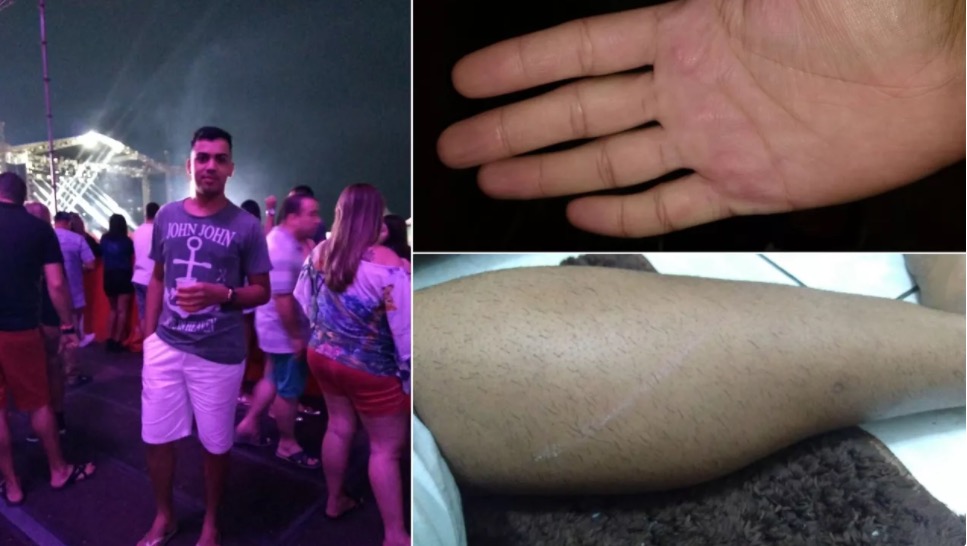 Jovem gay é espancado durante show sertanejo: 'não consegui entender'