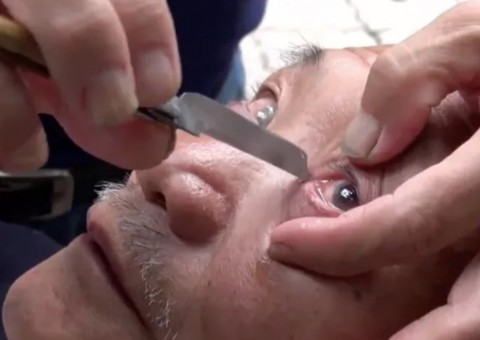 Homem ‘barbeia' globos oculares para limpar visão e técnica surpreende. Veja vídeo 