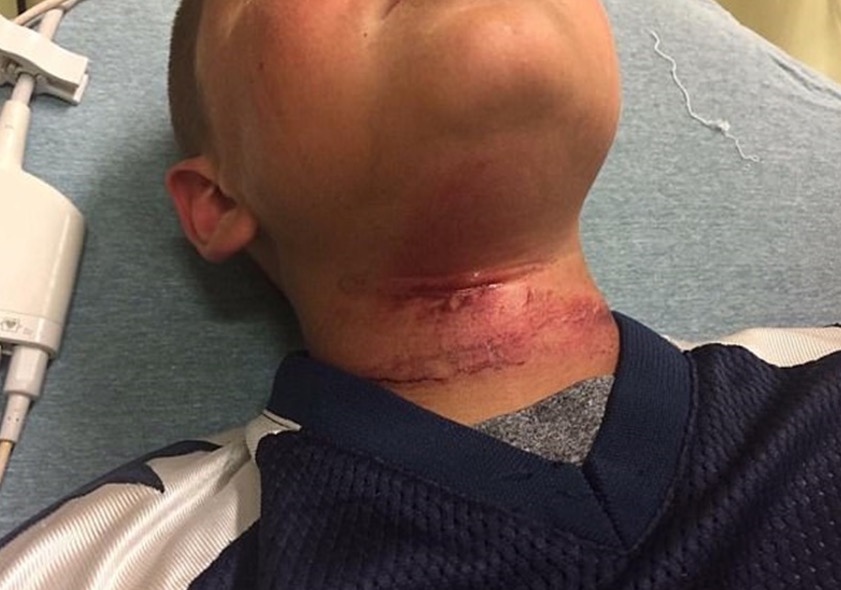 Menino de 8 anos é enforcado por adolescente de 14 anos em ataque racista