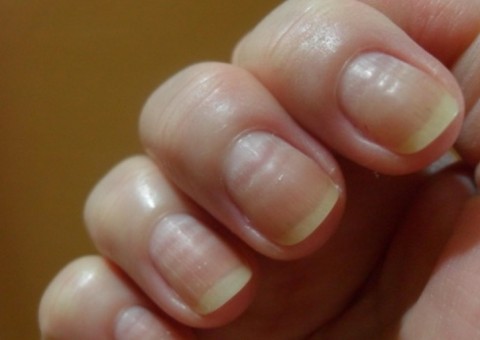 Produto natural é útil como amaciante, esfoliante e ainda combate fungos nas unhas 