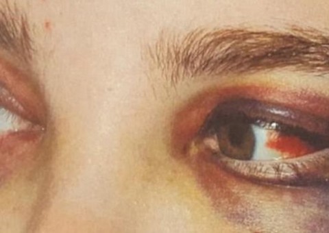 Babá é obrigada a tomar desinfetante após ser torturada por patrões 