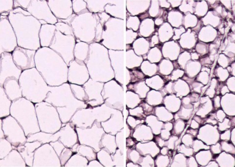 Cientistas transformam gordura ‘má’ em ‘boa’, aquela que ajuda a queimar calorias