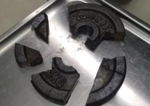 Homem é socorrido após ficar com o pênis entalado em anilha de academia 