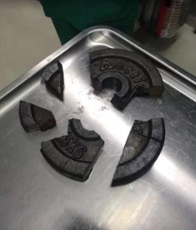 Homem é socorrido após ficar com o pênis entalado em anilha de academia 