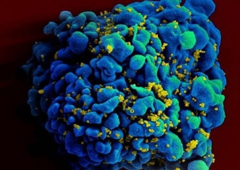 Anticorpo criado em laboratório combate 99% das cepas de HIV