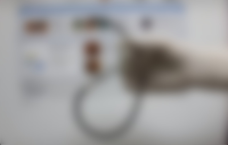 Médicos retiram tubo de estômago de mulher após 17 anos 