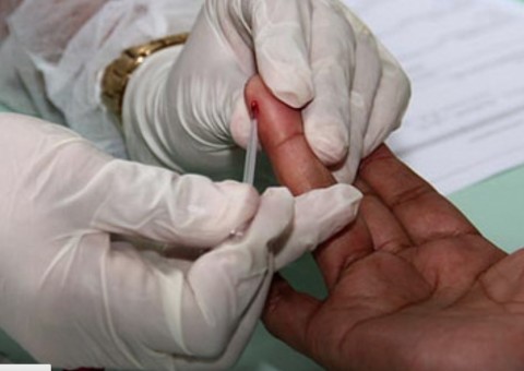 Campanha de combate à Sífilis começa em outubro no Amazonas 