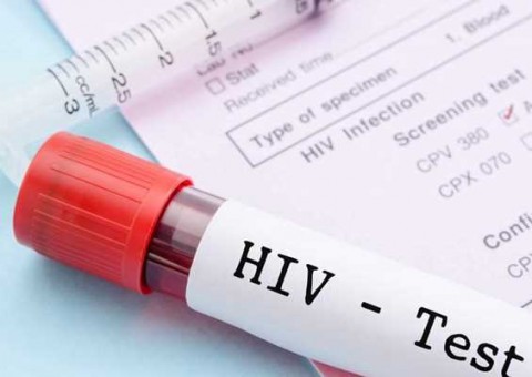 Saúde amplia oferta do tratamento para HIV/Aids com medicamento inovador