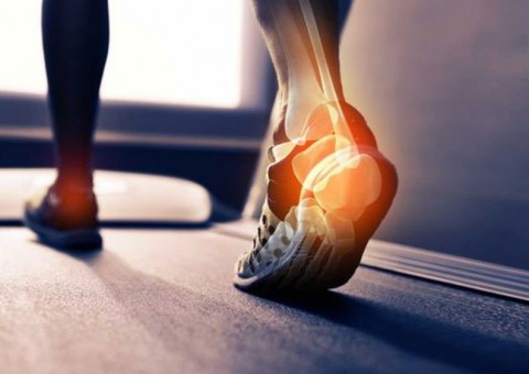 Fascite, a dor no calcanhar que afeta tanto sedentários como atletas