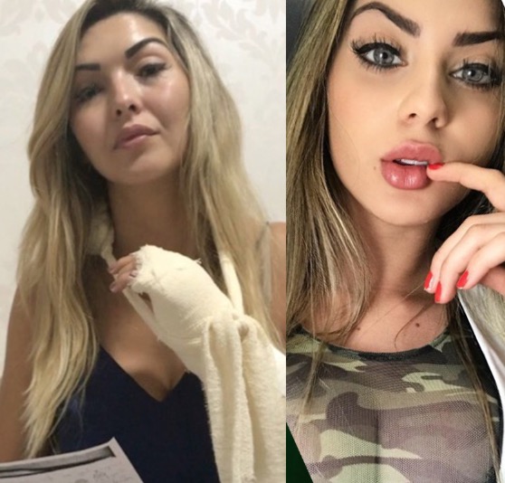 Universitária tem braço fraturado e acusa Mariana Castilho de agressão em shopping de Manaus