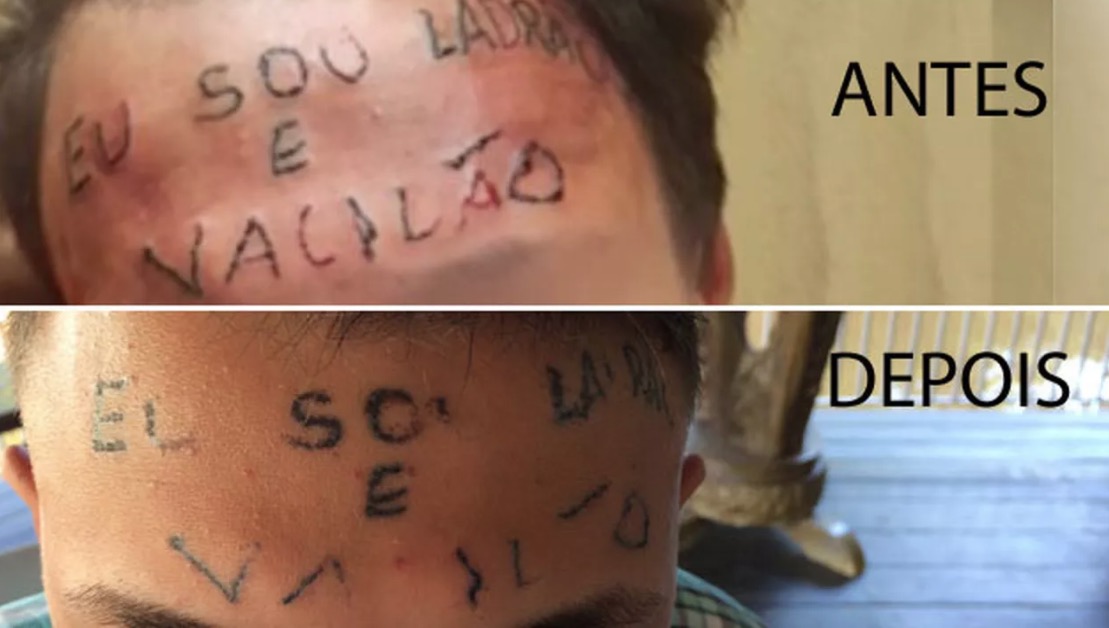 'Justiça já está feita', diz adolescente tatuado na testa
