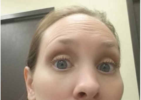 Mulher pensa que é simples cravo, mas descobre que volume no queixo é câncer 