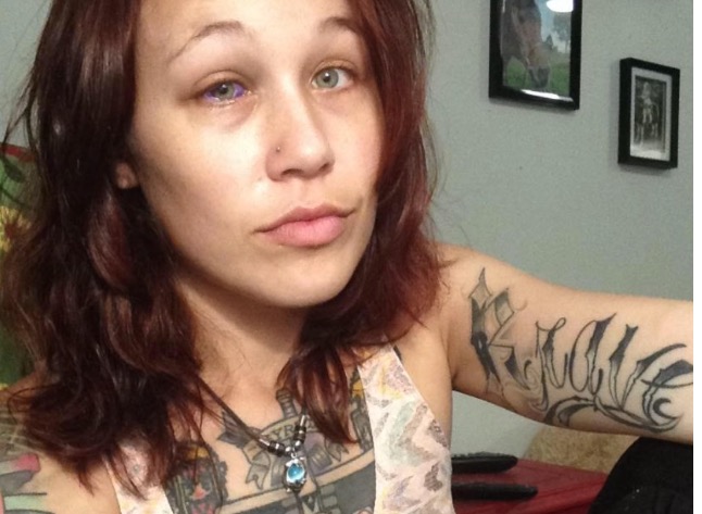 Jovem deixa namorado tatuar seu olho, mas procedimento não dá certo 