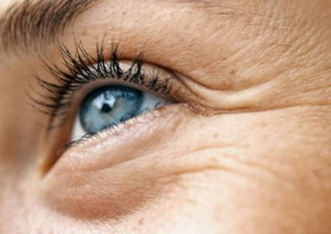 Elimine os pés de galinha do seu rosto com estas 6 dicas simples