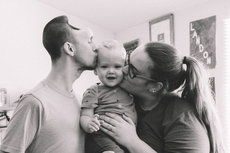 Homem perde parte do crânio por consumo excessivo de energéticos